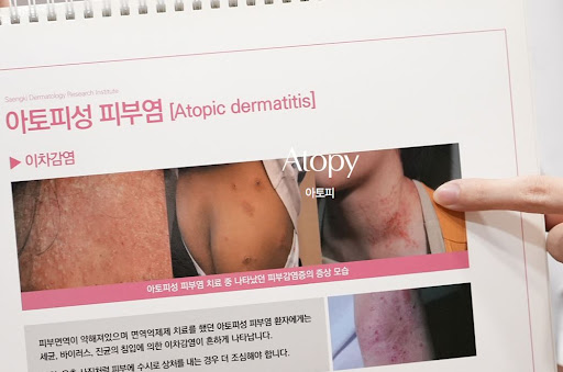 생기한의원이 아토피 피부염 기본 정보를 안내하는 방식